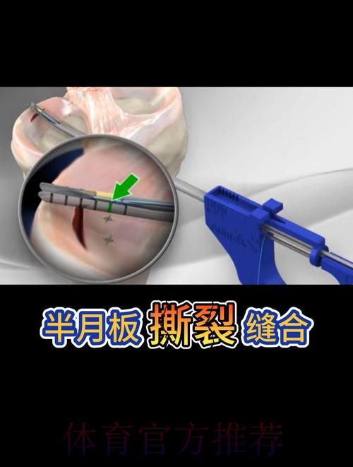 官方：阿拉巴成功接受了左膝内侧半月板撕裂手术